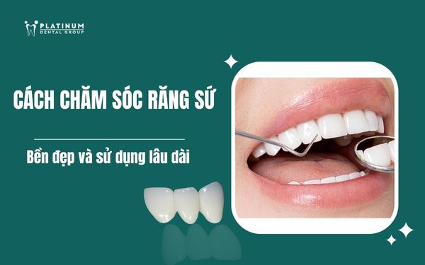 Cách Trồng Lan Kiều Vàng: Hướng Dẫn Chi Tiết Từ A Đến Z