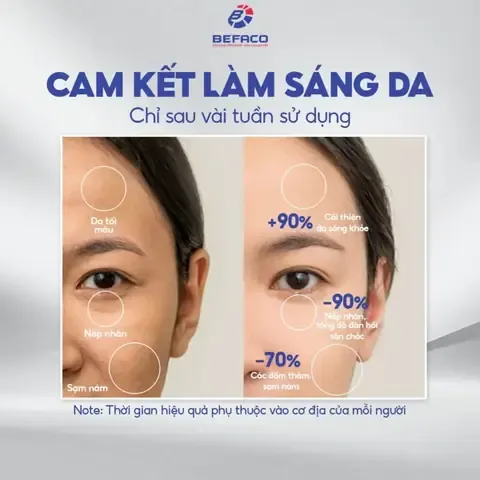Cây nha đam trong chậu, minh họa kỹ thuật chăm sóc cơ bản