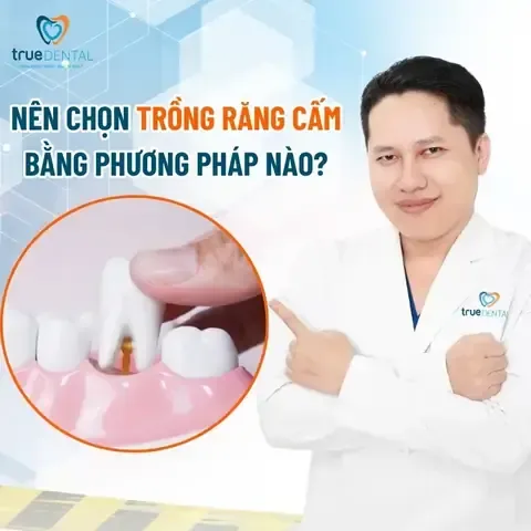 Cầu Răng Sứ - Giải pháp phục hình trong các cách trồng răng cấm truyền thống