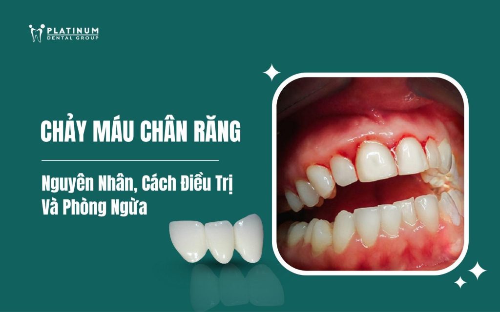 Cách Trồng Hoa Cẩm Tú Cầu Tại Nhà Toàn Diện: Kỹ Thuật Từ A Đến Z
