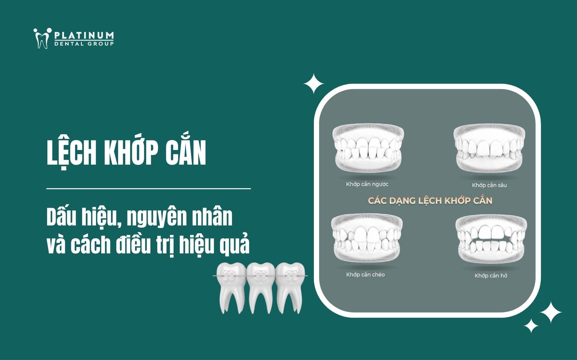 Cách Trồng Hoa Xuyến Chi Từ A Đến Z: Kỹ Thuật Chuyên Sâu Đảm Bảo Cây Nở Hoa Bền Vững