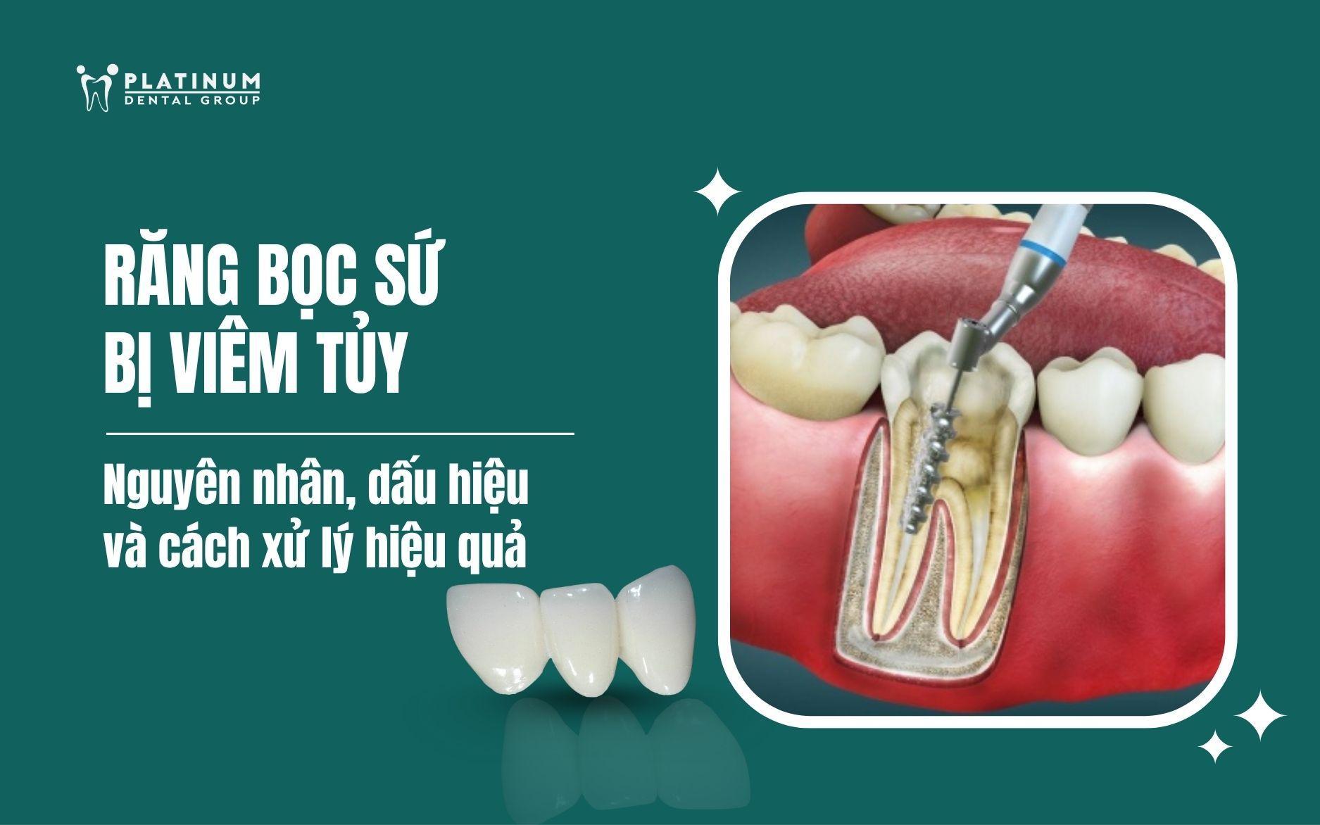 Cách Trồng Sứ Thái Lan Và Kỹ Thuật Chăm Sóc Đạt Chuẩn Chuyên Gia