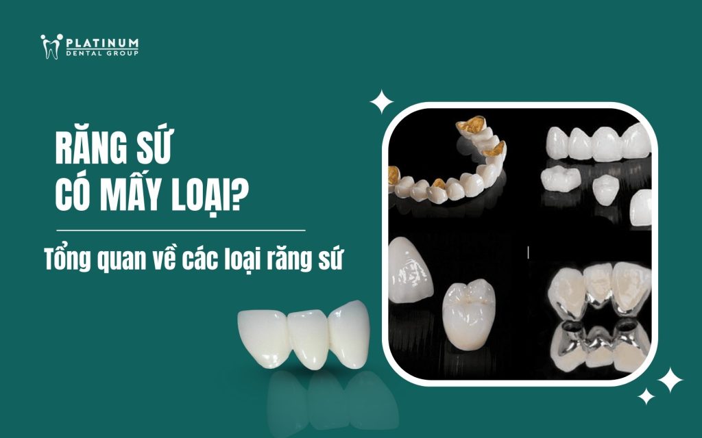 Các Cách Trồng Răng Giả: Phân Tích Chuyên Sâu Và Lựa Chọn Tối Ưu Các Cách Trồng Răng Giả: Phân Tích Chuyên Sâu Và Lựa Chọn Tối Ưu