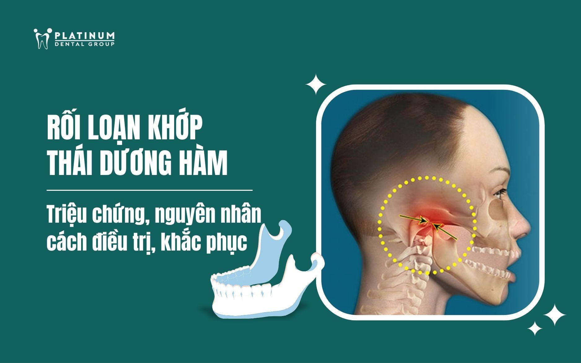Cách Trồng Hoa Xuyến Chi Từ A Đến Z: Kỹ Thuật Chuyên Sâu Đảm Bảo Cây Nở Hoa Bền Vững