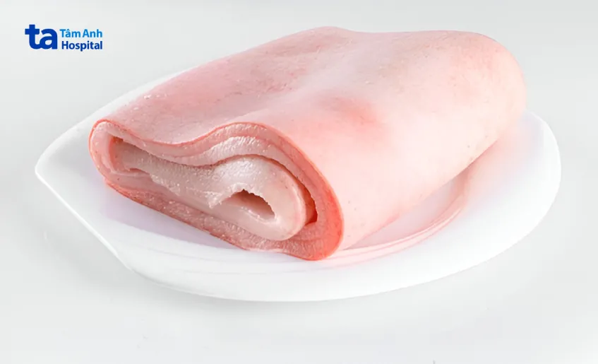 Da heo và các loại collagen chính