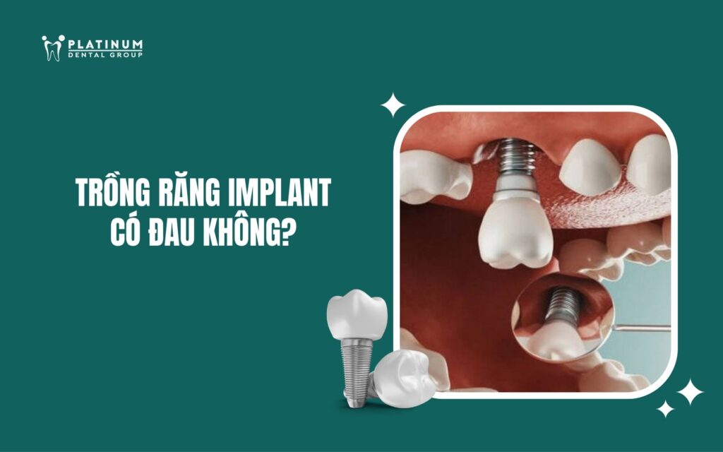 Cách Chăm Sóc Cây Hạnh Phúc Trồng Trong Nhà: Hướng Dẫn Toàn Diện Từ A Đến Z